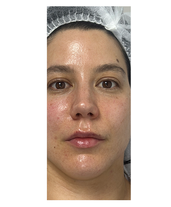 Paciente antes del tratamiento