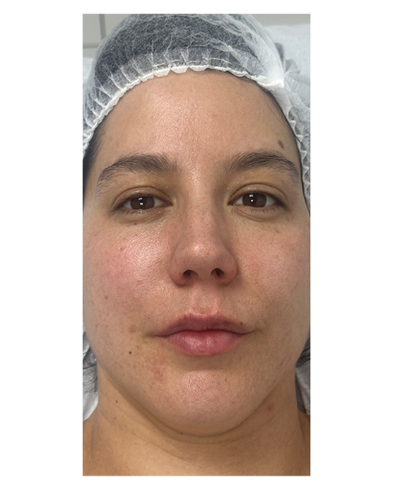 Paciente después del tratamiento